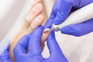 Medisch Pedicure
